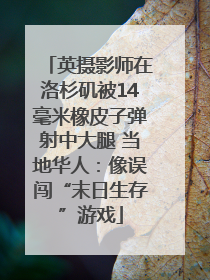 英摄影师在洛杉矶被14毫米橡皮子弹射中大腿 当地华人：像误闯“末日生存”游戏